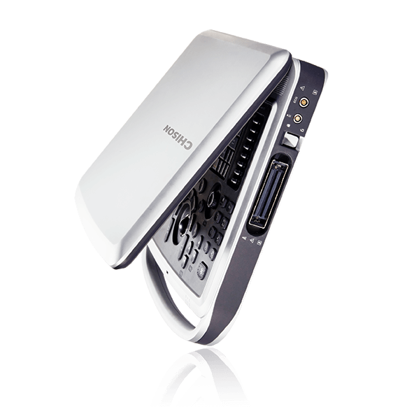 Ветеринарный УЗИ аппарат CHISON SonoTouch 80 (SonoBook 9)