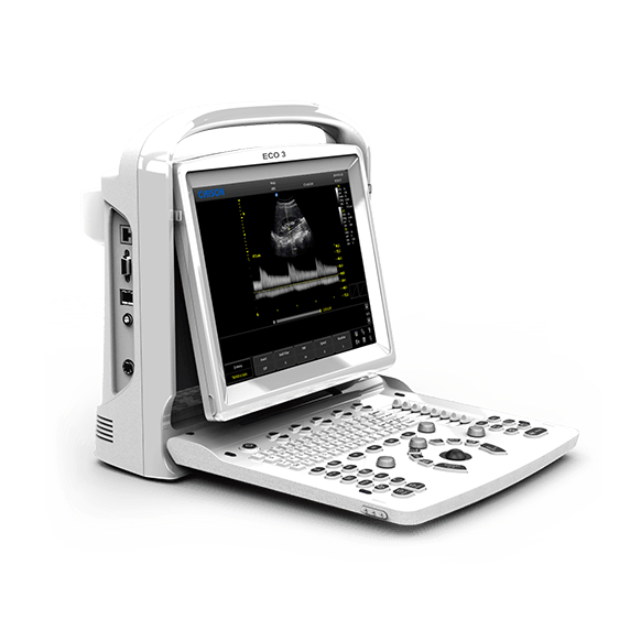 УЗИ аппарат CHISON ECO 3 Expert