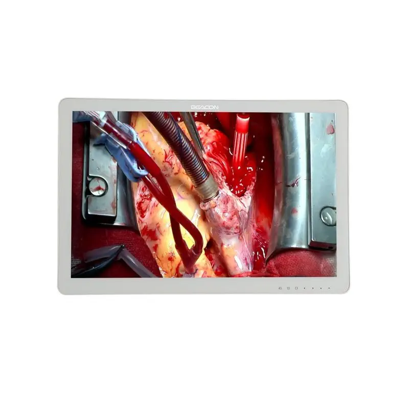 Видеомонитор медицинский 32″ Full HD Beacon