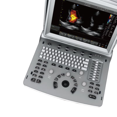 Ветеринарный УЗИ аппарат CHISON SonoTouch 50 (ECO 6)