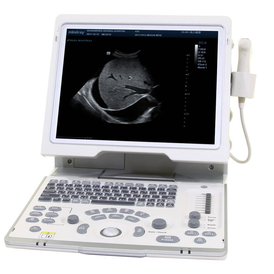 УЗИ аппарат Mindray DP-50