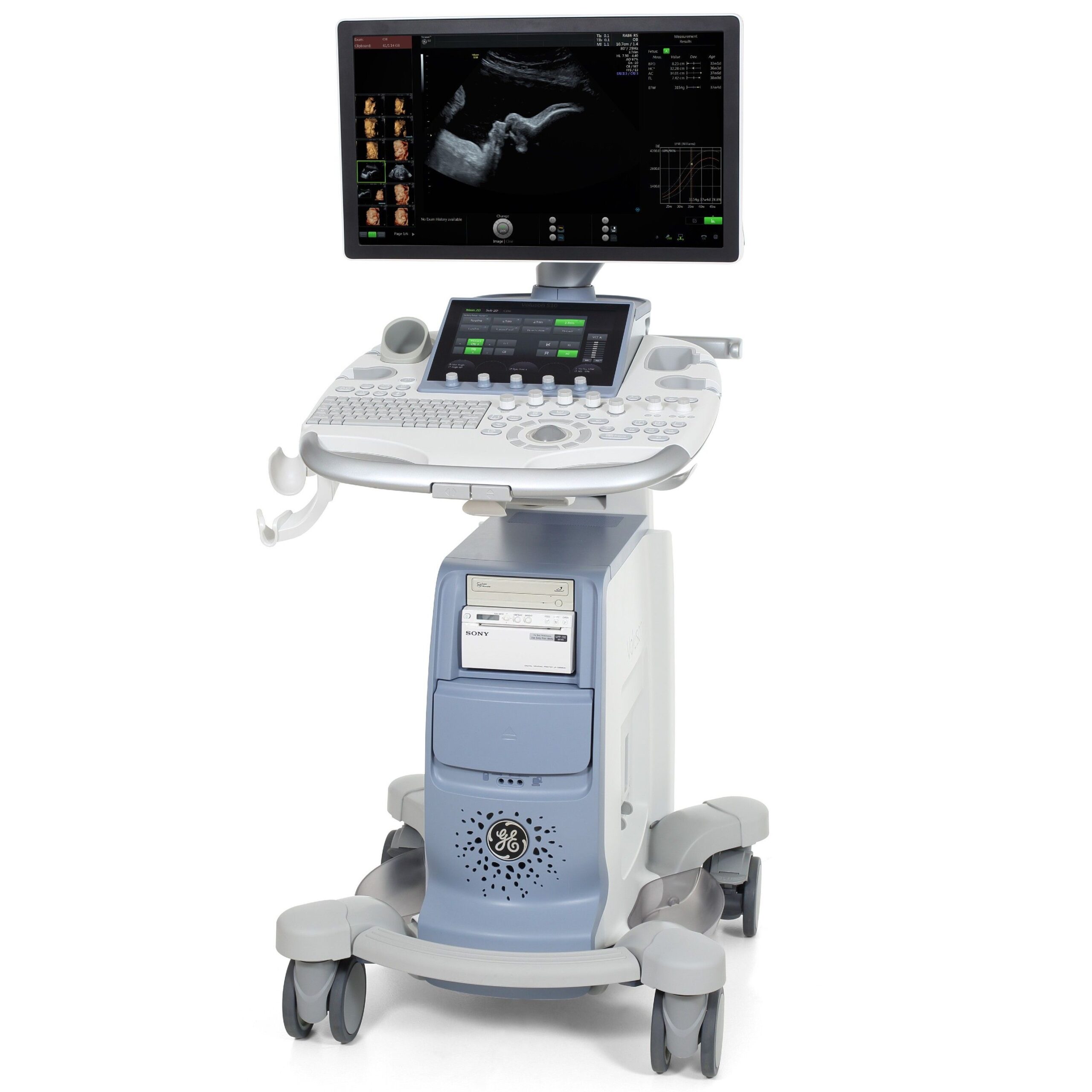 УЗИ аппарат GE Healthcare Voluson S10