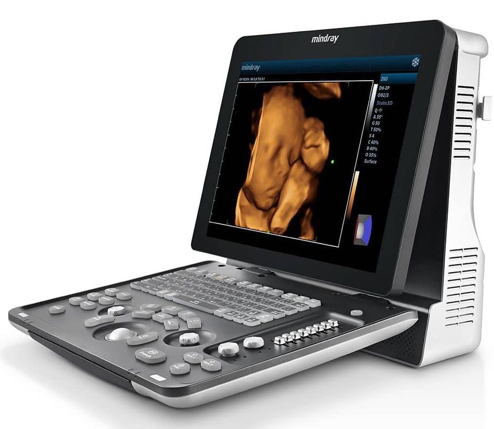 УЗИ аппарат Mindray Z60