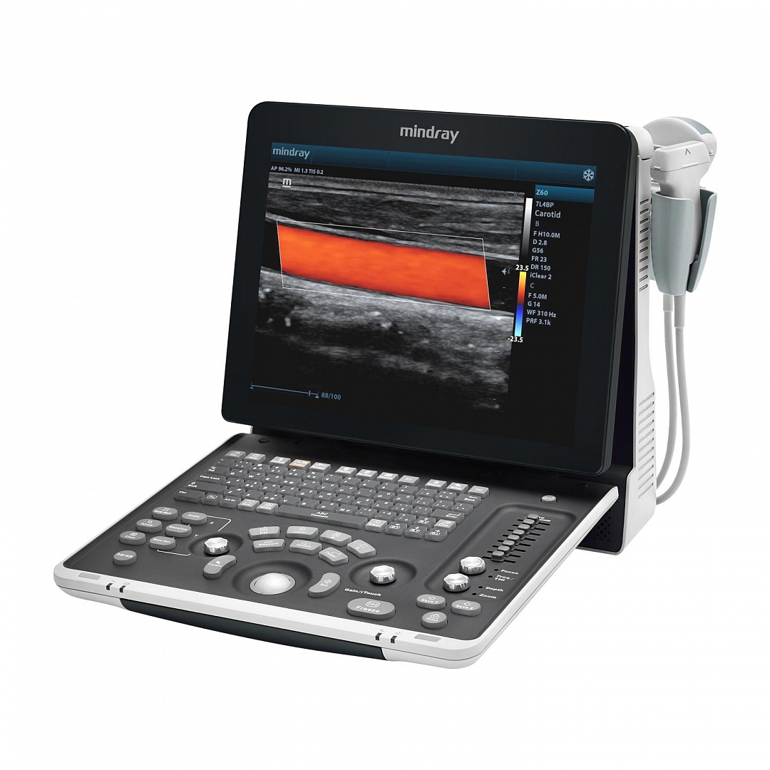 УЗИ аппарат Mindray Z60 Exp