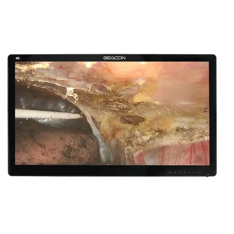 Видеомонитор медицинский 32″ ULTRA HD 4K Beacon
